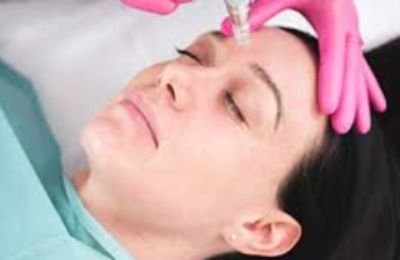 face having micro needle treatment