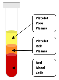 vials showing what happens to blood plasma after being in a centrifuge